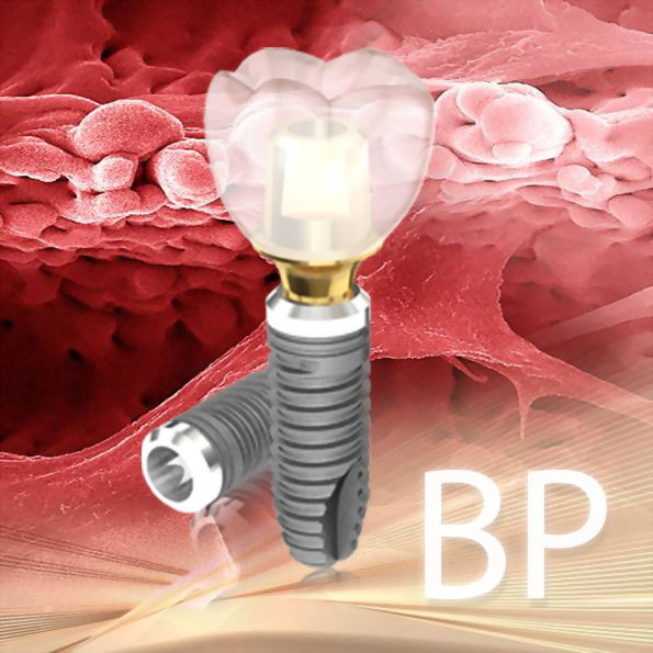 BiomatePlus植體系列