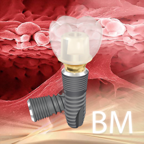 Biomate 植體系統