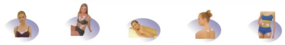 功能性低頻電刺激治療機