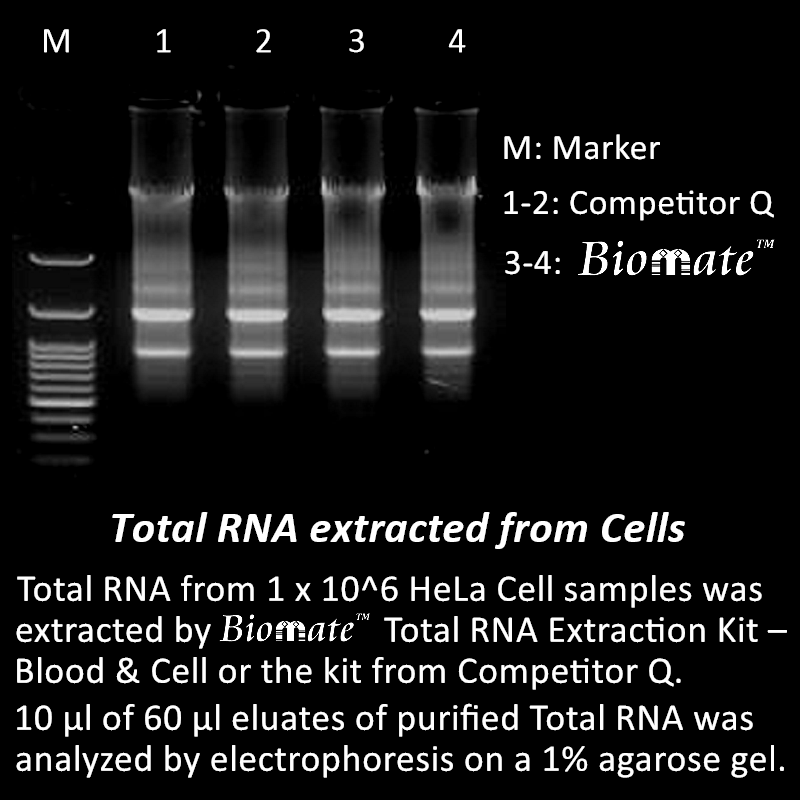 Rna Extraction Kit Low Cell Number at Josephine Blumberg blog