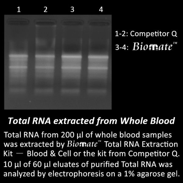 Total RNA Extraction Kit Blood & Cell