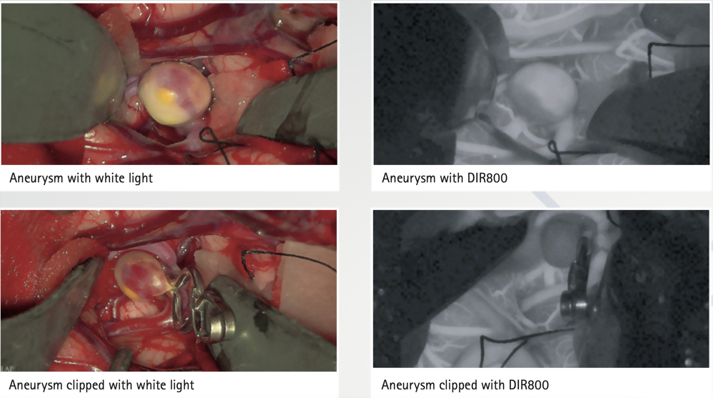 AESCULAP AEOS® ROBOTIC DIGITAL MICROSCOPE