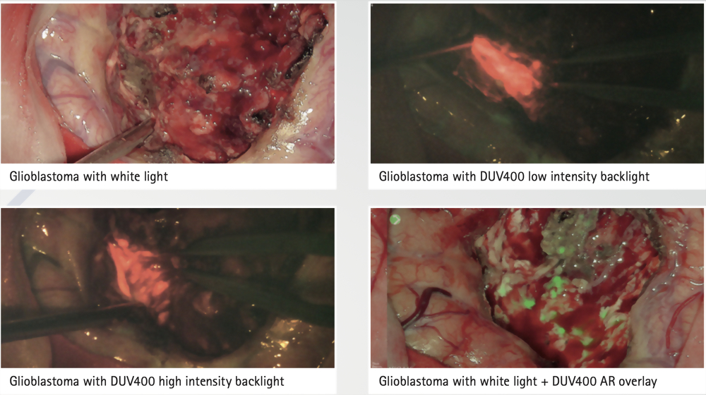 AESCULAP AEOS® ROBOTIC DIGITAL MICROSCOPE