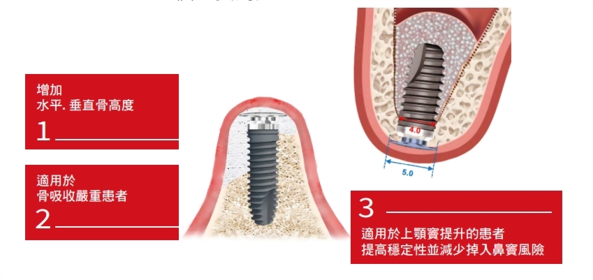 Membrane Screw三大主要用途