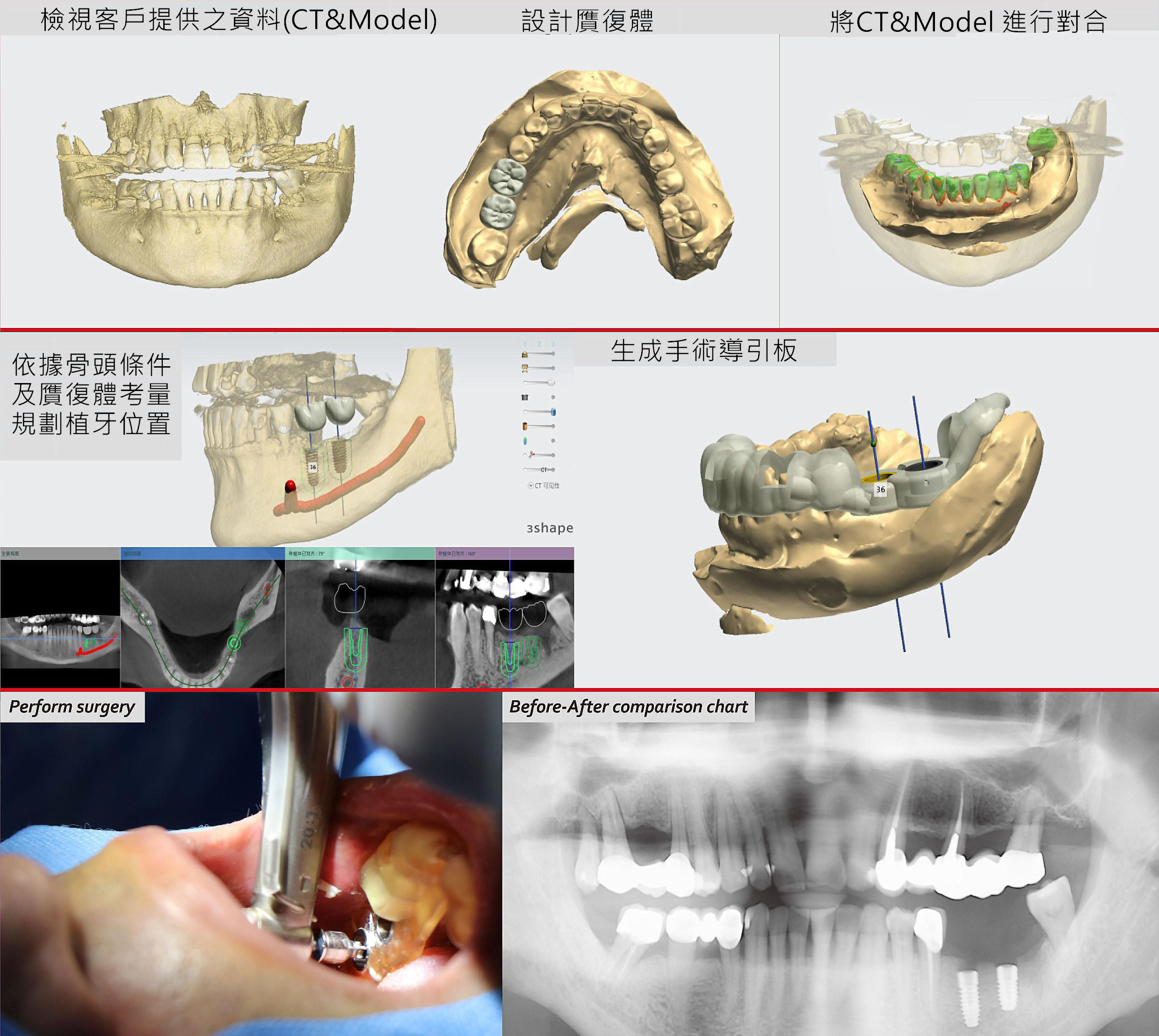 3D 影像診斷與手術模擬系統