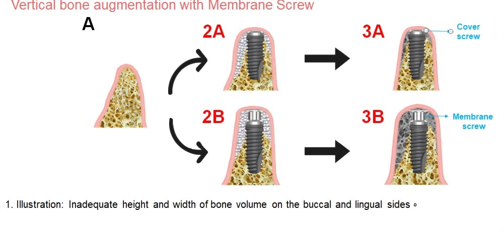 臨床空間比較示意圖
