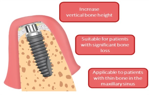 臨床應用優勢圖