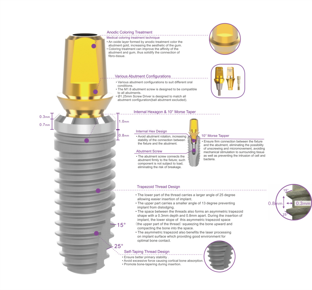 Biomate-Plusインプラントシステム