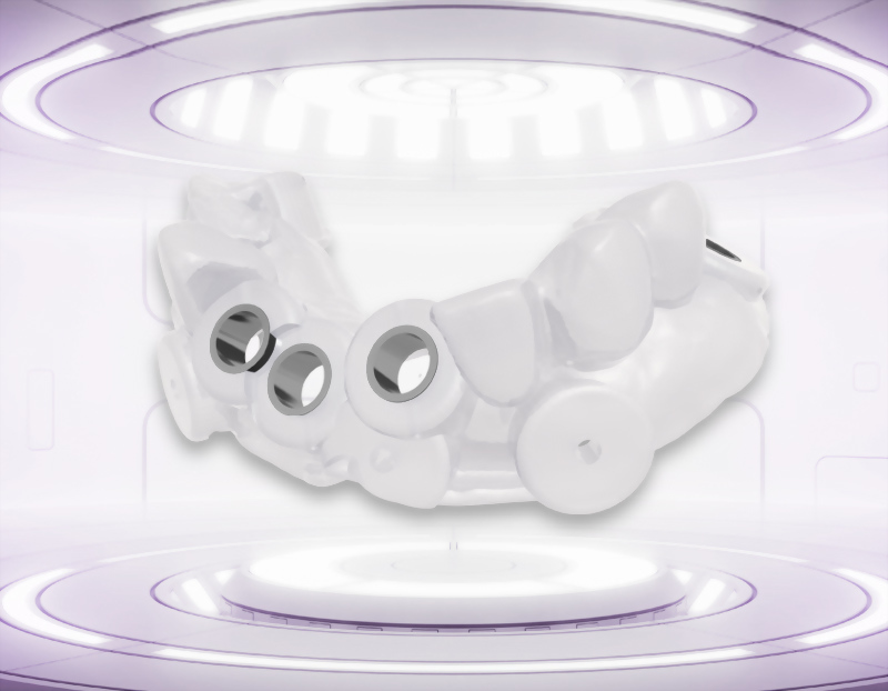 Digital Surgical Guide