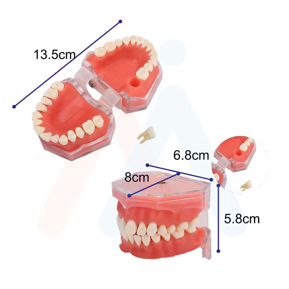 全口可拔牙根構造模型