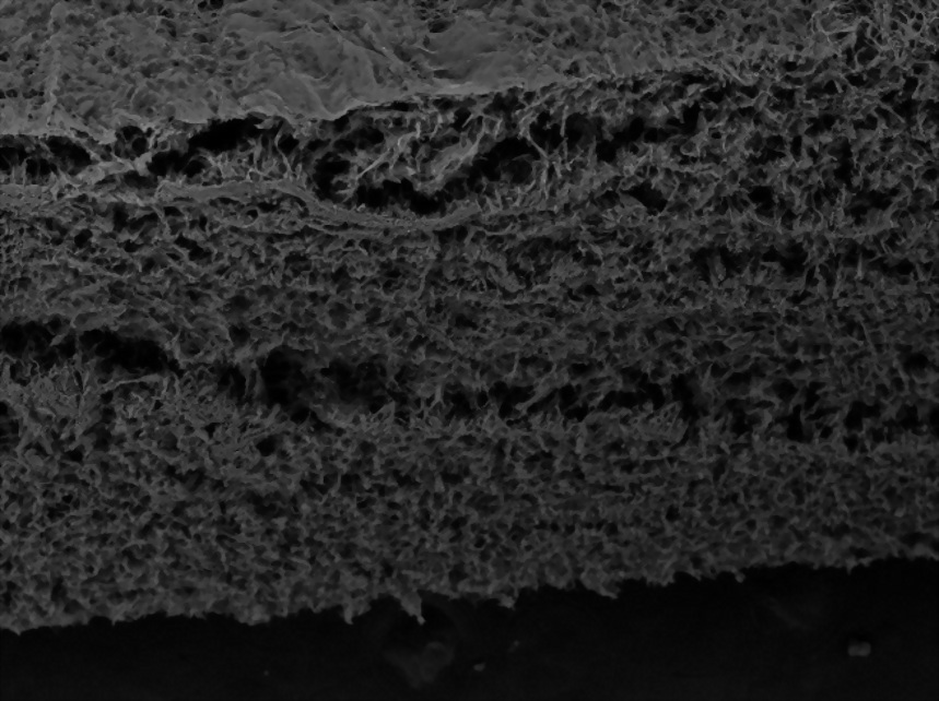 海昌膠原蛋白基質Horien Collagen Matrix