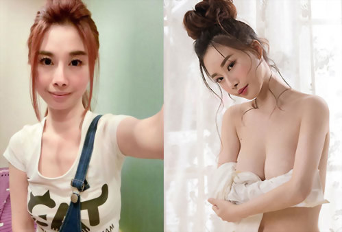 Motiva魔滴隆乳術後效果加倍奉還！多層次筋膜腹部拉皮+Motiva魔滴隆乳手術產後媽咪補奶縮腹，老公：比產前更辣！