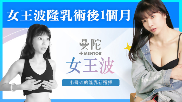 女王波【真人案例分享】術前術後曼陀女王波隆乳心得